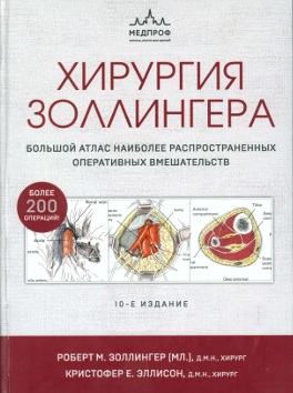 Хирургия золлингера