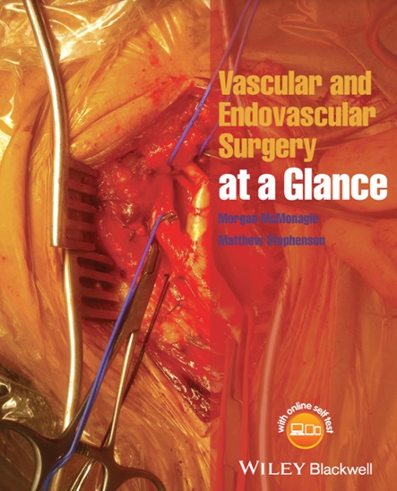Vascular and endovascular surgery at a glance