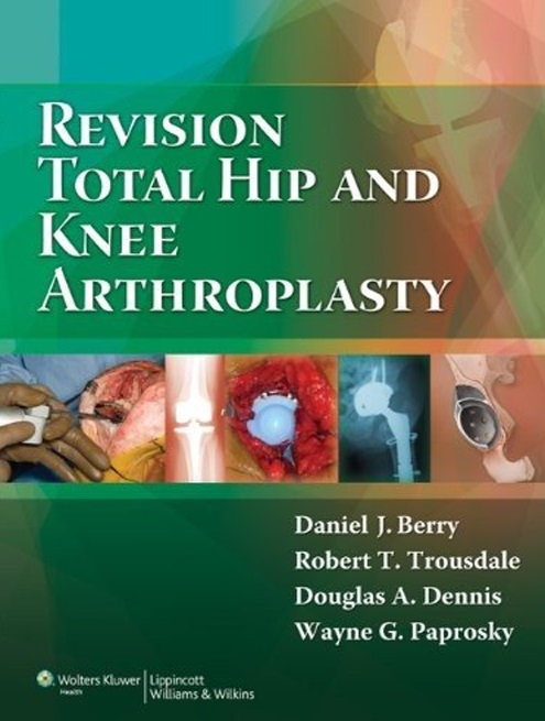 Revision total hip and knee arthroplasty