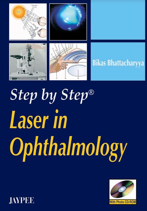Laser in ophthalmology