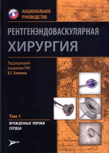 Рентгенэндоваскулярная хирургия