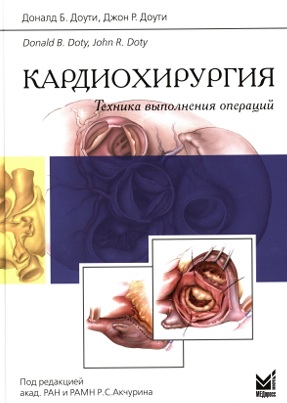 Кардиохирургия