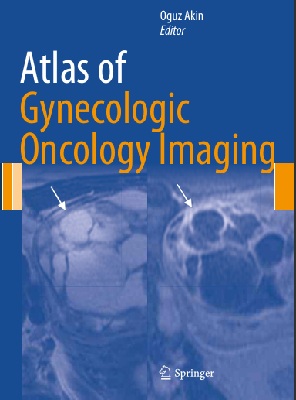 Atlas of Gynecologic  Oncology Imaging