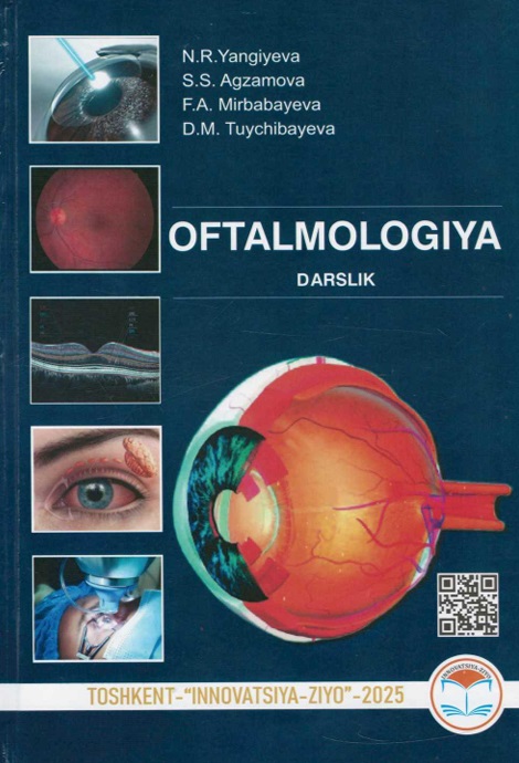 Oftalmologiya