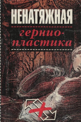 Ненатяжная герниопластика