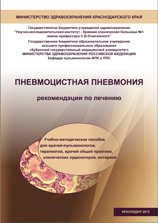Пневмоцистная пневмония рекомендации по лечению