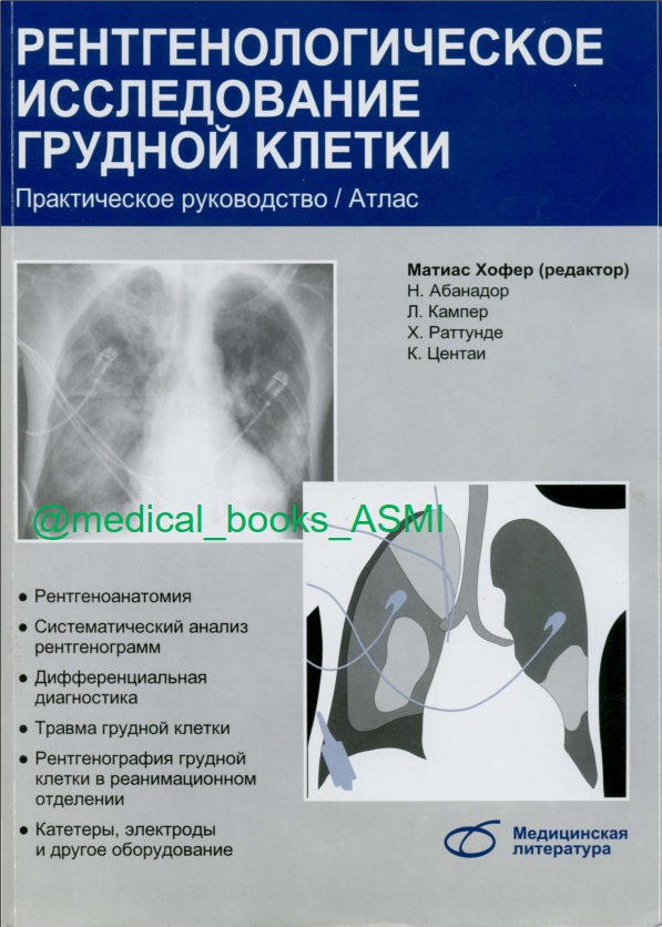 Рентгенологическое исследование грудной клетки