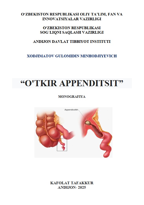 O'tkir apenditsit