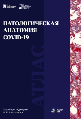 Патологическая анатомия COVID-19: Атлас