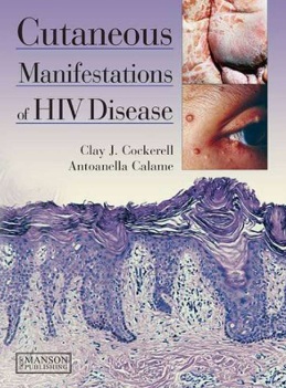 Сutaneous manifestations of hiv disease