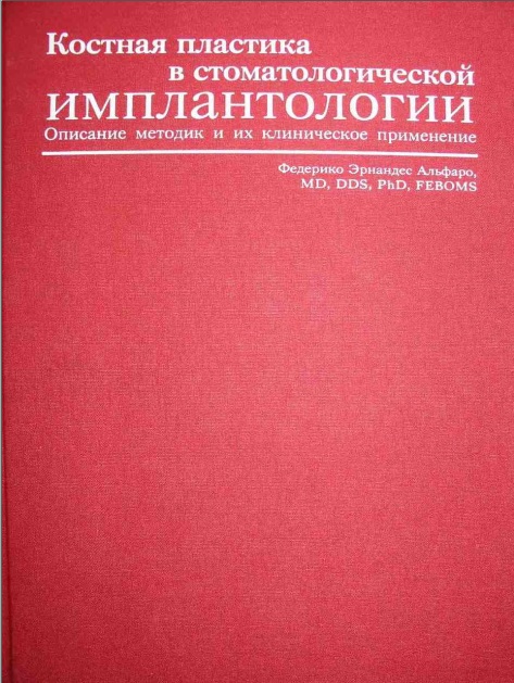 Костная пластика в стоматологической имплантологии