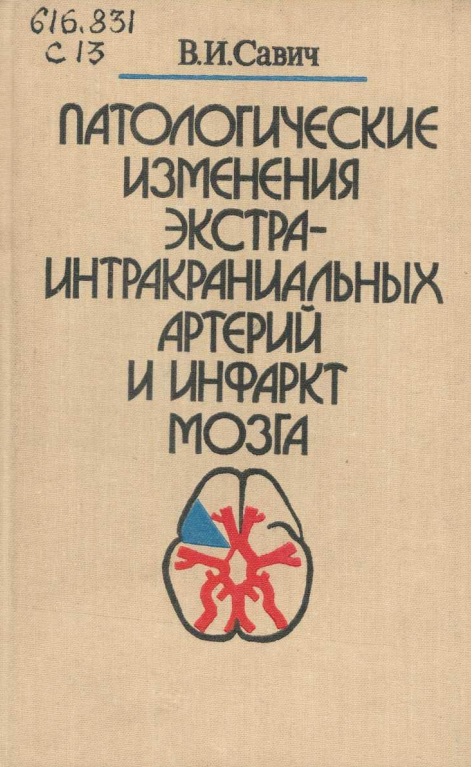 Патологические изменения экстраинтракраниальнқх артерий и инфаркт мозга