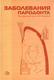 Заболевания пародонта
