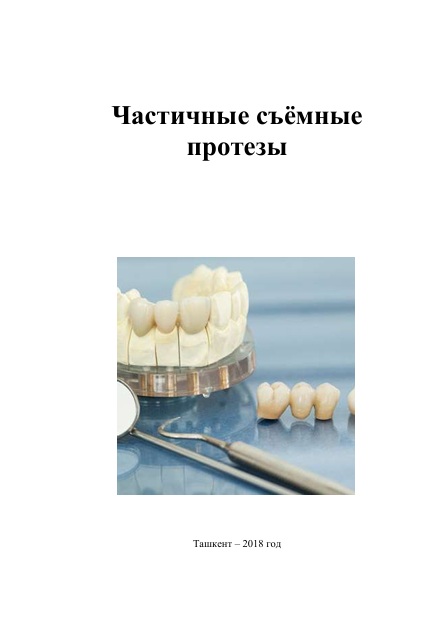 Частичные сьёмные протезы