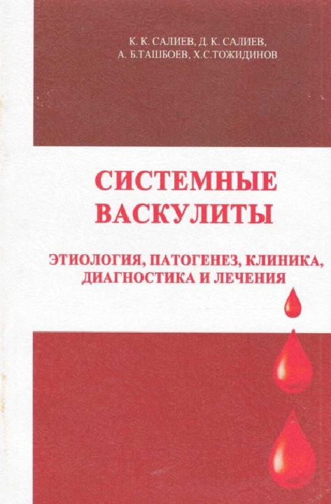 Системные васкулиты