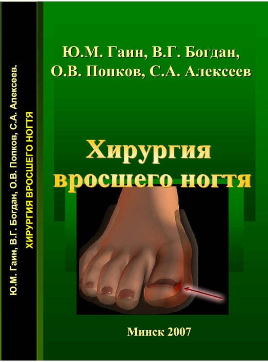 Хирургия вросшего ногтя