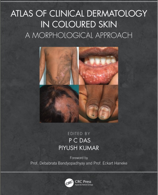 Atlas of clinical dermatology in coloured skin: a morphological approach
