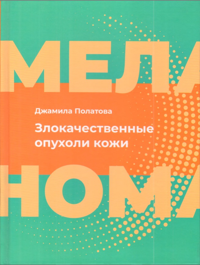 Злокачественные опухоли кожи меланома