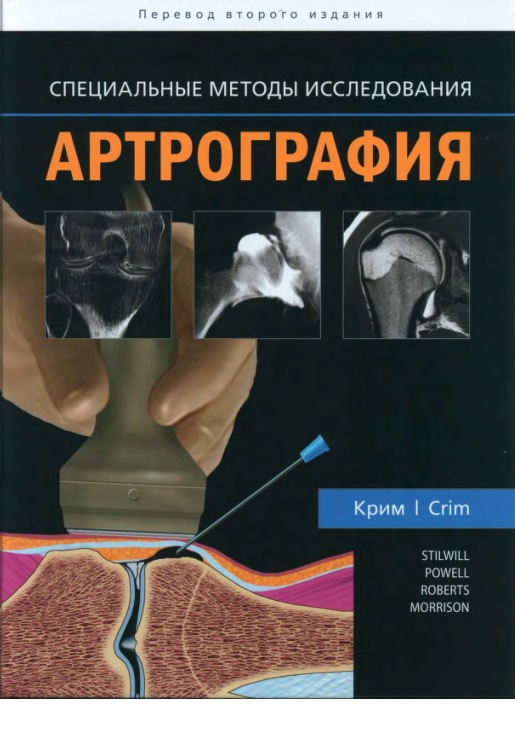 Артрография