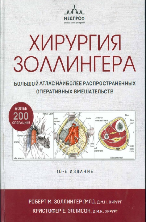 Хирургия золлингера