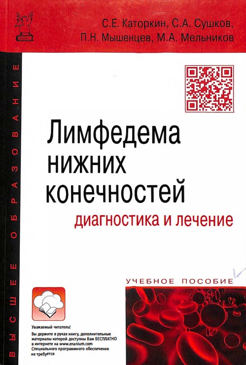 Лимфедема нижних конечностей диагностика и лечение