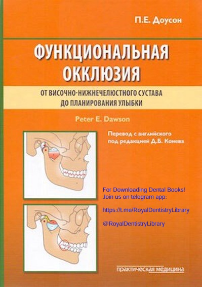 Функциональная окклюзия
