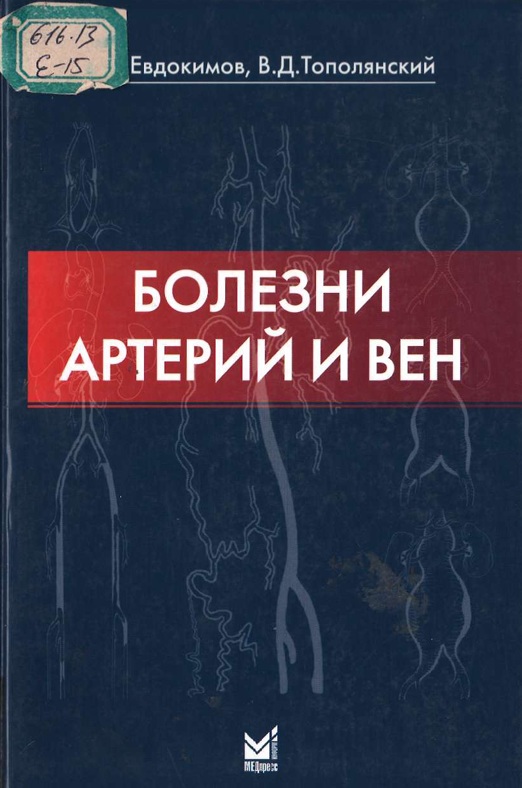Болезни артерий и вен