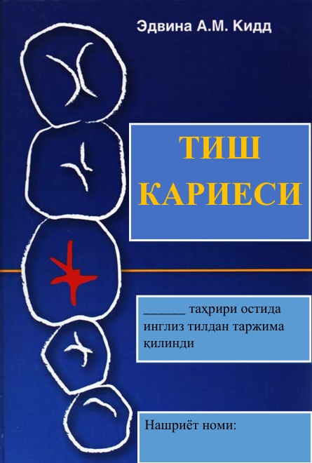 Тиш кариеси