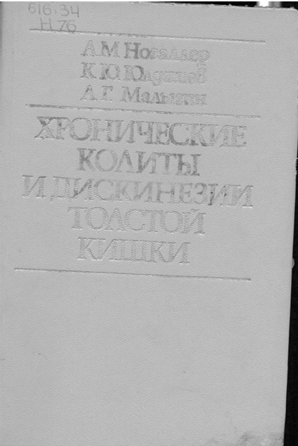 Хронические колиты и дискинезии толстой кишки
