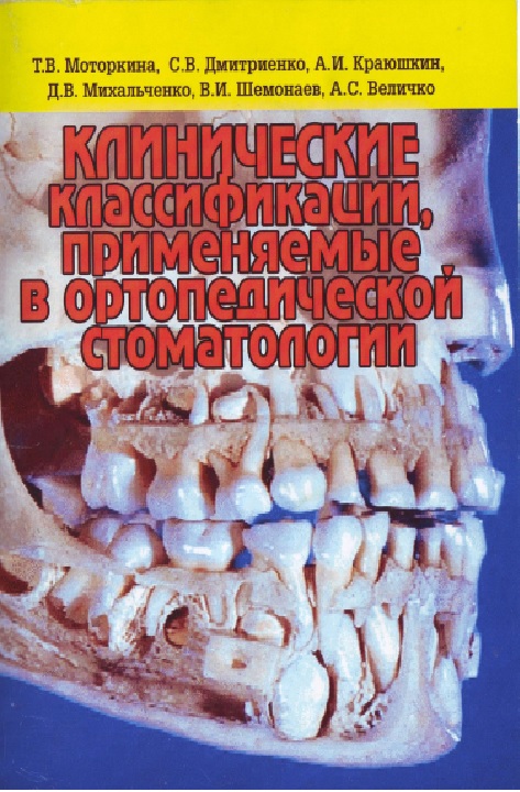 Клинические классификации, применяемые в ортопедической стоматологии