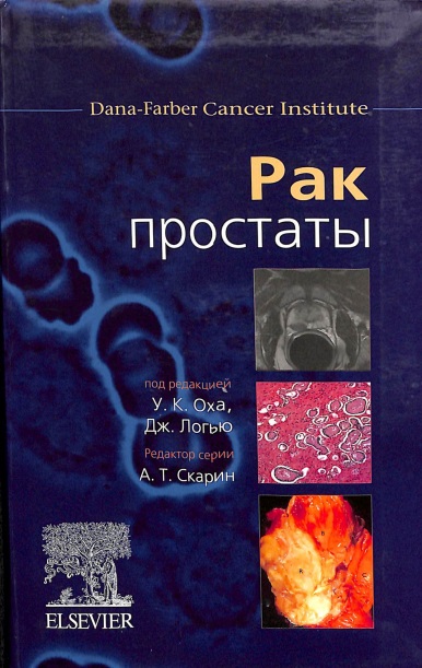 Рак простаты=Prostate Cancer