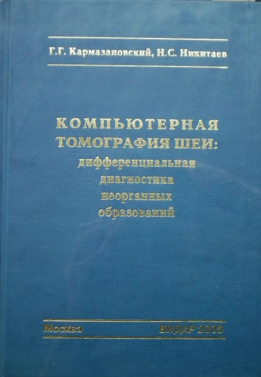 Компьютерная томография шеи: дифференциальная диагностика неорганных образований
