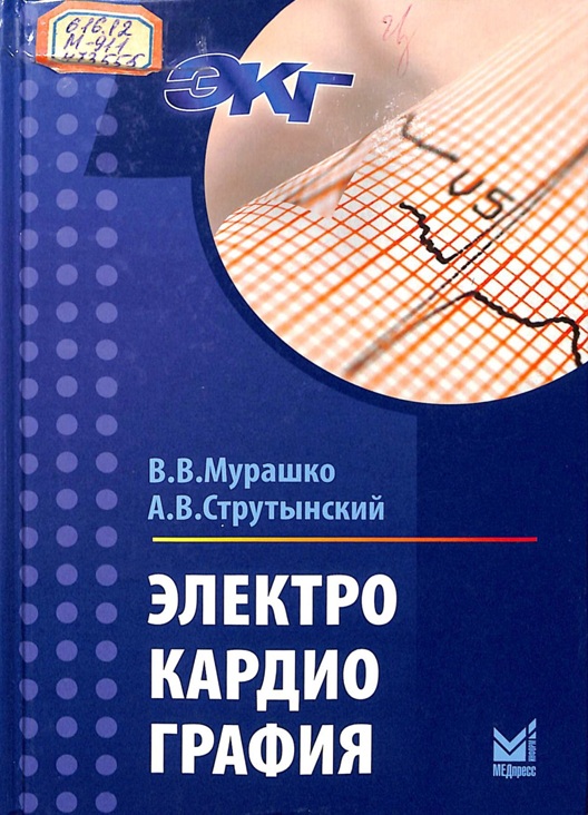 Электрокардиография