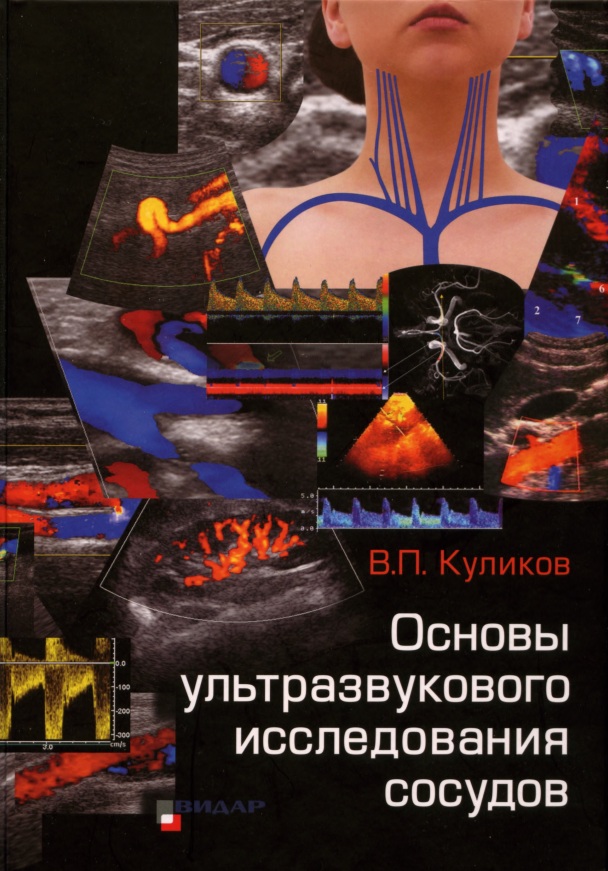 Основы ультразвукового исследования сосудов
