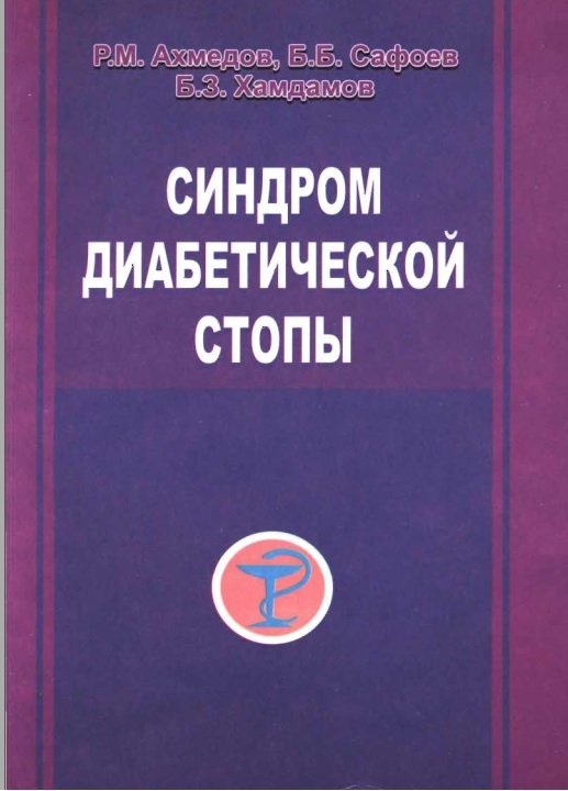 Синдром диабетической стопы