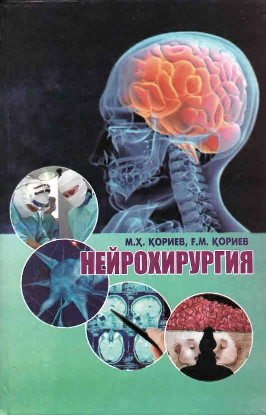 Нейрохирургия