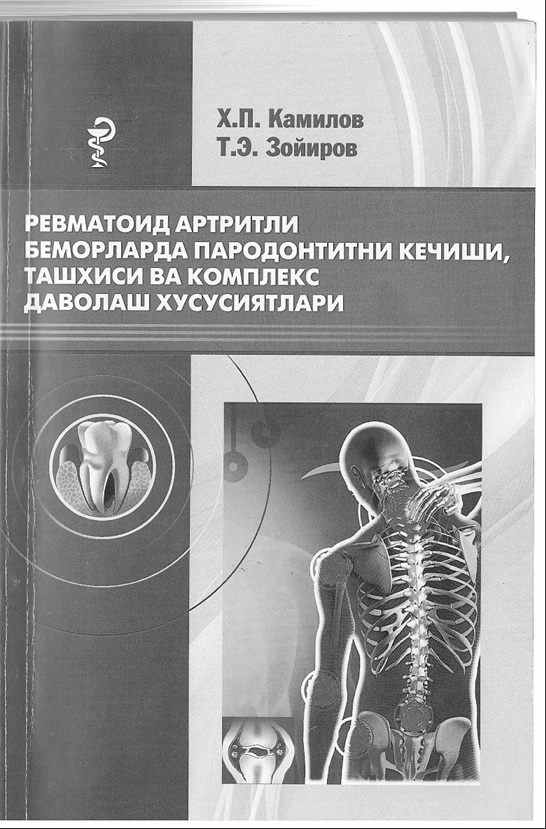 Ревматоид артритли беморларда пародонтитни кечиши, ташхиси ва компелекс даволаш хусусиятлари