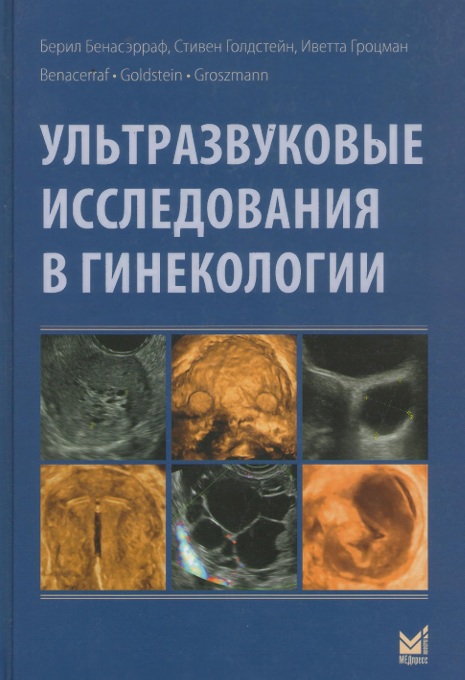 Ультразвуковые исследования в гинекологии
