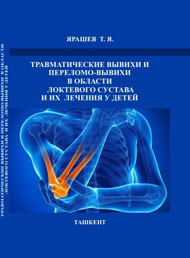 Травматические вывихи и переломо-вывихи в области локтевого сустава и их лечения у детей