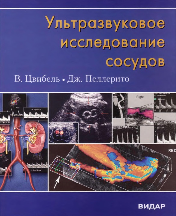 Ультразвукове обстеження судин