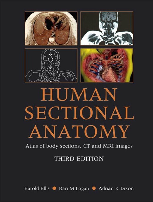 Human sectional anatomy: atlas of body sections, CT and MRI images