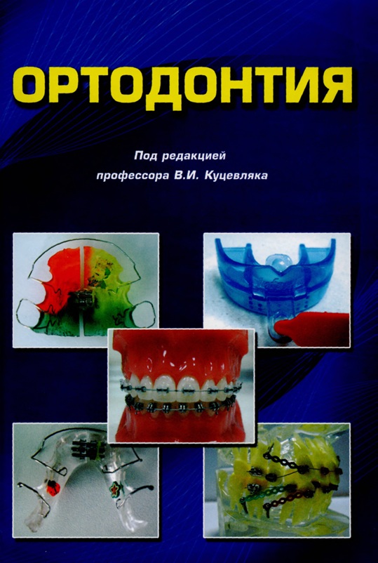Ортодонтия