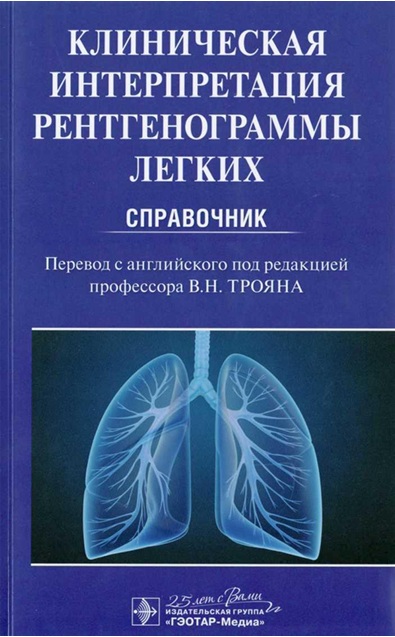 Клиническая интерпретация рентгенограммы легких