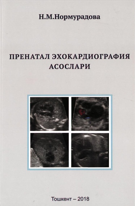 Пренатал эхокардиография асослари