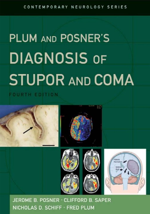Plum and Posner's diagnosis of stupor and coma