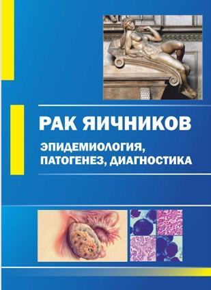 Рак яичников: эпидемиология, патогенез, диагностика