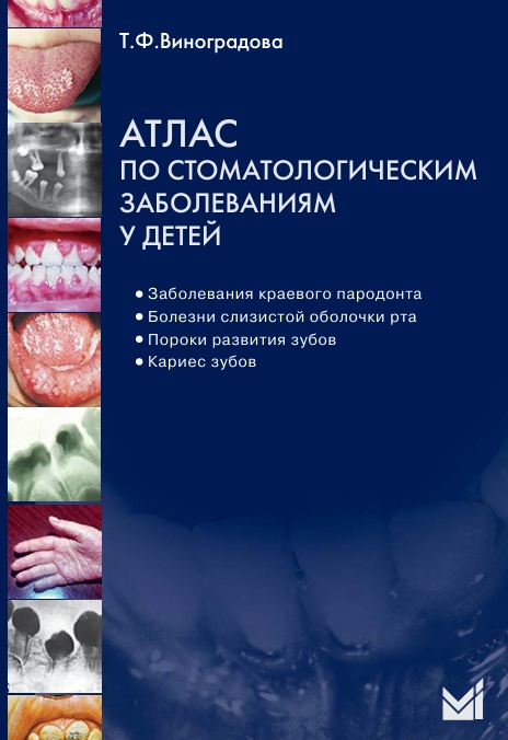 Атлас по стоматологическим заболеваниям у детей
