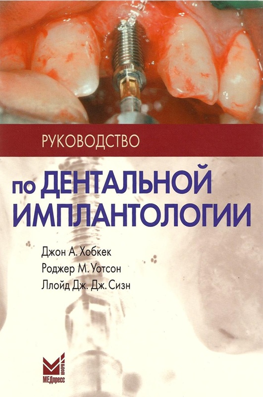Руководство  по дентальной  имплантологии