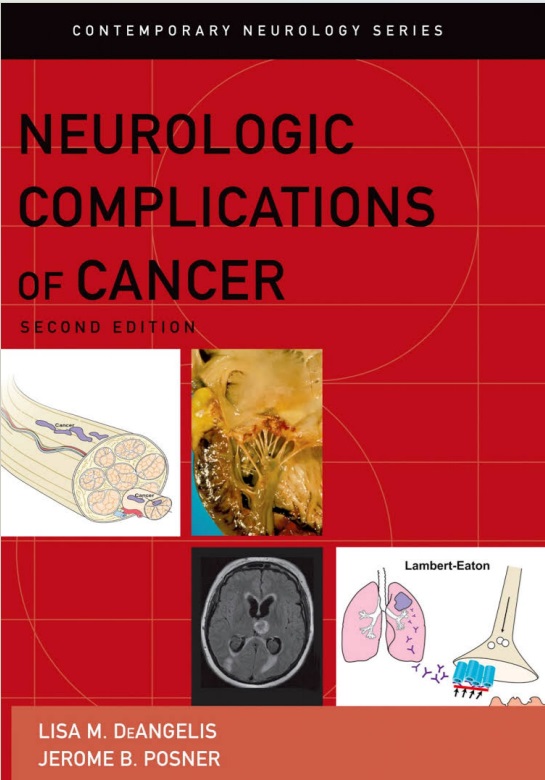 Neurologic complications of cancer