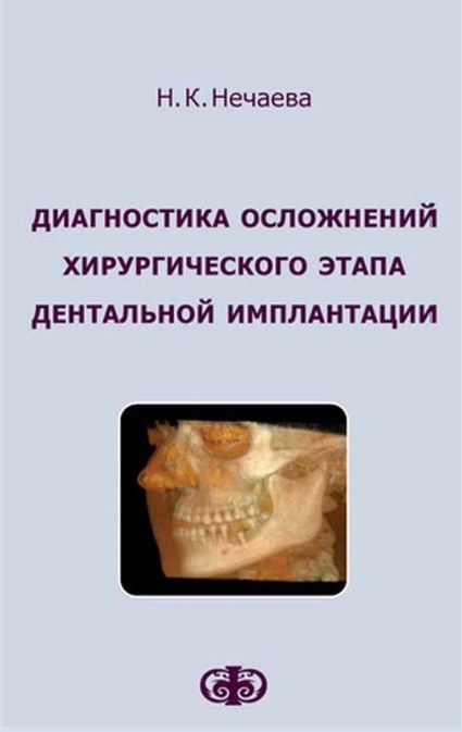 Диагностика осложнений хирургического  этапа дентальной имплантации